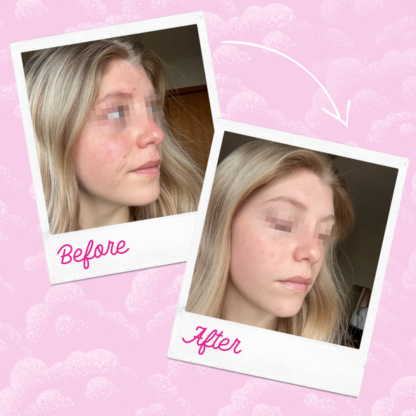 7-Day Set - Make Up Eraser - Silver Infused Pink